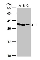 Anti-ASB9 antibody [N1C3] used in Western Blot (WB). GTX107216