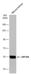 Anti-ZNF398 antibody [C1C3] used in Western Blot (WB). GTX107221
