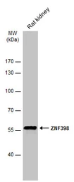 Anti-ZNF398 antibody [C1C3] used in Western Blot (WB). GTX107221