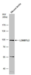 Anti-L3MBTL2 antibody used in Western Blot (WB). GTX107234