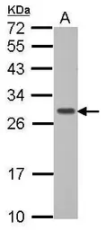 Anti-GIMAP6 antibody [N1C3] used in Western Blot (WB). GTX107241