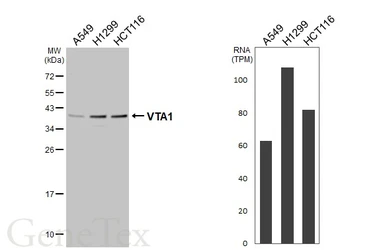 Anti-VTA1 antibody used in Western Blot (WB). GTX107286
