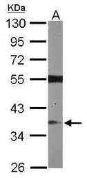 Anti-RASSF2 antibody [N1C3] used in Western Blot (WB). GTX107315