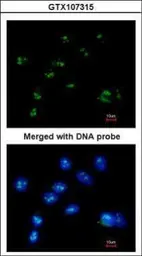 Anti-RASSF2 antibody [N1C3] used in Immunocytochemistry/ Immunofluorescence (ICC/IF). GTX107315