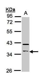 Anti-RASSF2 antibody [N1C3] used in Western Blot (WB). GTX107315