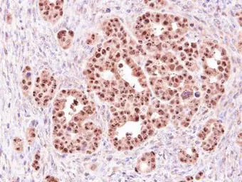 Anti-ALOXE3 antibody [N1N3] used in IHC (Paraffin sections) (IHC-P). GTX107325