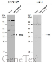 Anti-TFIIB antibody [N1C3] used in Western Blot (WB). GTX107327