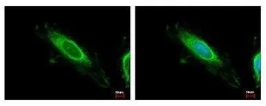 Anti-TBRG4 antibody used in Immunocytochemistry/ Immunofluorescence (ICC/IF). GTX107336