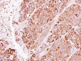 Anti-TBRG4 antibody used in IHC (Paraffin sections) (IHC-P). GTX107336