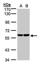 Anti-TBRG4 antibody used in Western Blot (WB). GTX107336