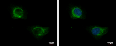 Anti-KRT71 antibody [N3C3] used in Immunocytochemistry/ Immunofluorescence (ICC/IF). GTX107343