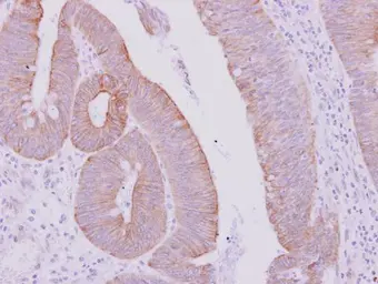 Anti-KRT71 antibody [N3C3] used in IHC (Paraffin sections) (IHC-P). GTX107343