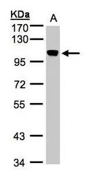 Anti-BRRN1 antibody used in Western Blot (WB). GTX107344