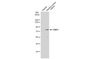 Anti-PAF1 antibody used in Western Blot (WB). GTX107346