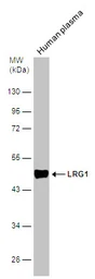 Anti-LRG1 antibody [N1C3] used in Western Blot (WB). GTX107355
