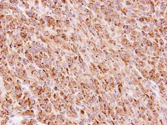 Anti-TTC30A antibody [C1C3] used in IHC (Paraffin sections) (IHC-P). GTX107359
