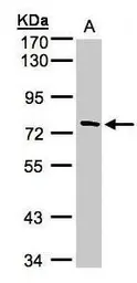 Anti-TTC30A antibody [C1C3] used in Western Blot (WB). GTX107359