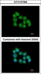 Anti-MBNL3 antibody [N1C3] used in Immunocytochemistry/ Immunofluorescence (ICC/IF). GTX107366