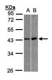 Anti-MBNL3 antibody [N1C3] used in Western Blot (WB). GTX107366