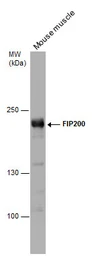 Anti-FIP200 antibody [N1N2], N-term used in Western Blot (WB). GTX107387