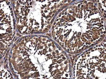 Anti-FIP200 antibody [N1N2], N-term used in IHC (Paraffin sections) (IHC-P). GTX107387