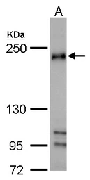 Anti-FIP200 antibody [N1N2], N-term used in Western Blot (WB). GTX107387