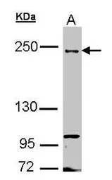 Anti-FIP200 antibody [N1N2], N-term used in Western Blot (WB). GTX107387