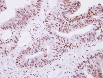 Anti-Selenophosphate synthetase 1 antibody used in IHC (Paraffin sections) (IHC-P). GTX107395