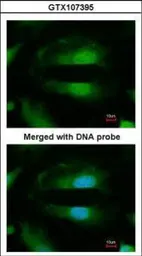 Anti-Selenophosphate synthetase 1 antibody used in Immunocytochemistry/ Immunofluorescence (ICC/IF). GTX107395