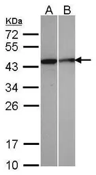 Anti-Selenophosphate synthetase 1 antibody used in Western Blot (WB). GTX107395
