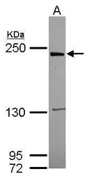 Anti-LRRK1 antibody [C1C2], Internal used in Western Blot (WB). GTX107407