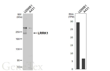 Anti-LRRK1 antibody [C1C2], Internal used in Western Blot (WB). GTX107407