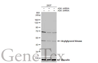 Anti-Acylglycerol kinase antibody used in Western Blot (WB). GTX107413