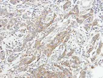 Anti-STK3 antibody used in IHC (Paraffin sections) (IHC-P). GTX107417