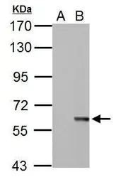 Anti-STK3 antibody used in Western Blot (WB). GTX107417