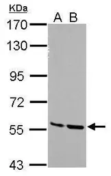 Anti-STK3 antibody used in Western Blot (WB). GTX107417