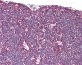 Anti-Lck antibody [N1C1] used in IHC (Paraffin sections) (IHC-P). GTX107432