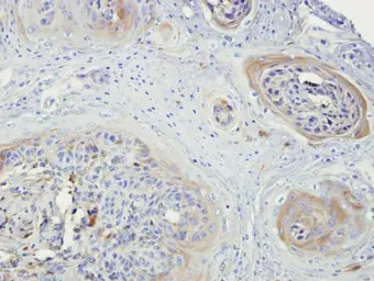 Anti-NEK3 antibody [N1C1] used in IHC (Paraffin sections) (IHC-P). GTX107436