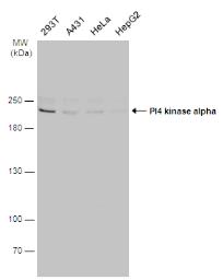 Anti-PI4 kinase alpha antibody [C1C2], Internal used in Western Blot (WB). GTX107441