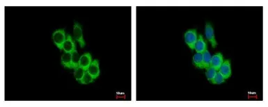 Anti-FRK antibody used in Immunocytochemistry/ Immunofluorescence (ICC/IF). GTX107456