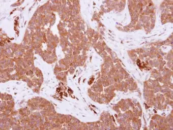 Anti-FRK antibody used in IHC (Paraffin sections) (IHC-P). GTX107456