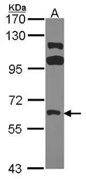 Anti-FRK antibody used in Western Blot (WB). GTX107456