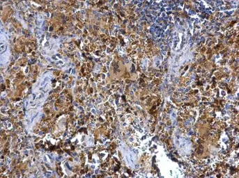 Anti-Syk antibody [N1C1] used in IHC (Paraffin sections) (IHC-P). GTX107459