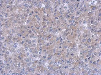 Anti-Syk antibody [N1C1] used in IHC (Paraffin sections) (IHC-P). GTX107459