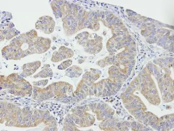 Anti-DAPP1 antibody [N1C3-2] used in IHC (Paraffin sections) (IHC-P). GTX107466