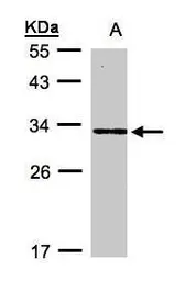 Anti-DAPP1 antibody [N1C3-2] used in Western Blot (WB). GTX107466