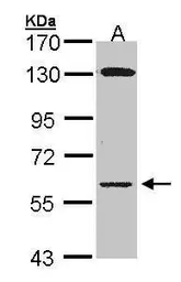 Anti-Glycerol kinase antibody [N1N3-2] used in Western Blot (WB). GTX107474