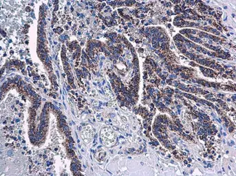 Anti-Adenylate kinase 4 antibody [N1C3-2] used in IHC (Paraffin sections) (IHC-P). GTX107482