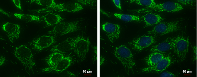 Anti-Adenylate kinase 4 antibody [N1C3-2] used in Immunocytochemistry/ Immunofluorescence (ICC/IF). GTX107482