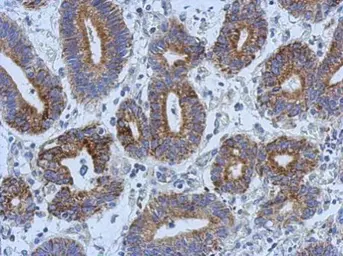Anti-Adenylate kinase 4 antibody [N1C3-2] used in IHC (Paraffin sections) (IHC-P). GTX107482